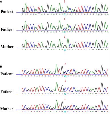 Syndromic and non-syndromic etiologies causing neonatal hypocalcemic seizures